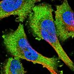 PKC mu Antibody in Immunocytochemistry (ICC/IF)