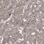 PKC mu Antibody in Immunohistochemistry (Paraffin) (IHC (P))