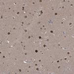 KPNB1 Antibody in Immunohistochemistry (Paraffin) (IHC (P))