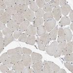 KPNB1 Antibody in Immunohistochemistry (Paraffin) (IHC (P))