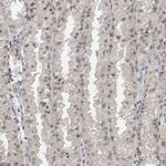 KPNB1 Antibody in Immunohistochemistry (Paraffin) (IHC (P))