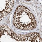 KPNB1 Antibody in Immunohistochemistry (Paraffin) (IHC (P))