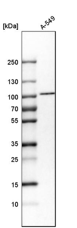 KPNB1 Antibody in Western Blot (WB)