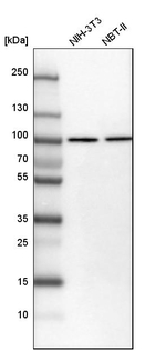 KPNB1 Antibody in Western Blot (WB)