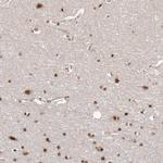 SOX4 Antibody in Immunohistochemistry (Paraffin) (IHC (P))