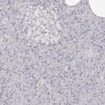 SOX4 Antibody in Immunohistochemistry (Paraffin) (IHC (P))
