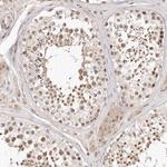 SOX4 Antibody in Immunohistochemistry (Paraffin) (IHC (P))