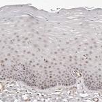 SOX4 Antibody in Immunohistochemistry (Paraffin) (IHC (P))