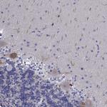 PLXNA4 Polyclonal Antibody
