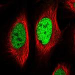 EGR1 Polyclonal Antibody