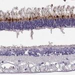 RD3 Antibody in Immunohistochemistry (Paraffin) (IHC (P))