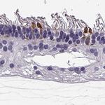RD3 Polyclonal Antibody