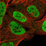 SMARCA2 Polyclonal Antibody