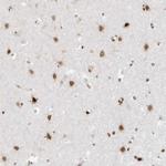 SMARCA2 Antibody in Immunohistochemistry (Paraffin) (IHC (P))