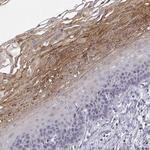 ERO1L Antibody in Immunohistochemistry (Paraffin) (IHC (P))