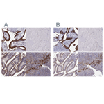 ERO1L Polyclonal Antibody