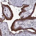 ERO1L Antibody in Immunohistochemistry (Paraffin) (IHC (P))