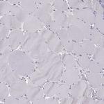 ERO1L Antibody in Immunohistochemistry (Paraffin) (IHC (P))