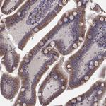 ERO1L Antibody in Immunohistochemistry (Paraffin) (IHC (P))