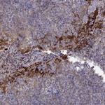 ERO1L Antibody in Immunohistochemistry (Paraffin) (IHC (P))