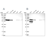 ERO1L Antibody in Western Blot (WB)