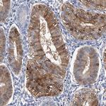 SERPINB9 Antibody in Immunohistochemistry (Paraffin) (IHC (P))