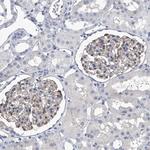 SERPINB9 Antibody in Immunohistochemistry (Paraffin) (IHC (P))