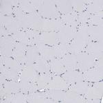 SERPINB9 Antibody in Immunohistochemistry (Paraffin) (IHC (P))