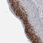 ZNF76 Antibody in Immunohistochemistry (Paraffin) (IHC (P))