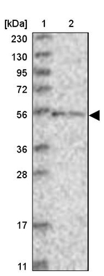 ZNF76 Antibody in Western Blot (WB)