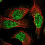 NUDT18 Polyclonal Antibody