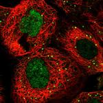 RFC3 Polyclonal Antibody