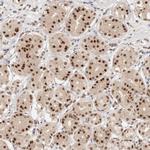 RFC3 Antibody in Immunohistochemistry (Paraffin) (IHC (P))