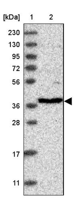 RFC3 Antibody in Western Blot (WB)