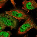 ATF5 Polyclonal Antibody