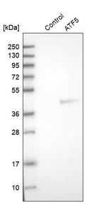 ATF5 Antibody in Western Blot (WB)