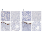Filaggrin Antibody in Immunohistochemistry (Paraffin) (IHC (P))
