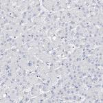 Filaggrin Antibody in Immunohistochemistry (Paraffin) (IHC (P))