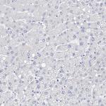 Filaggrin Antibody in Immunohistochemistry (Paraffin) (IHC (P))