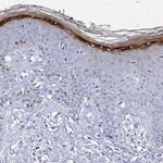 Filaggrin Antibody in Immunohistochemistry (Paraffin) (IHC (P))