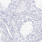 Filaggrin Antibody in Immunohistochemistry (Paraffin) (IHC (P))