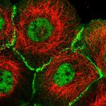 Afadin Antibody in Immunocytochemistry (ICC/IF)