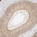 Afadin Antibody in Immunohistochemistry (Paraffin) (IHC (P))