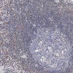 MX2 Antibody in Immunohistochemistry (Paraffin) (IHC (P))