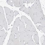 MX2 Antibody in Immunohistochemistry (Paraffin) (IHC (P))