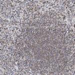 MX2 Antibody in Immunohistochemistry (Paraffin) (IHC (P))