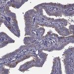 KIAA1751 Antibody in Immunohistochemistry (Paraffin) (IHC (P))