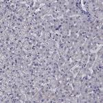 KIAA1751 Antibody in Immunohistochemistry (Paraffin) (IHC (P))