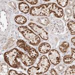ERK3 Antibody in Immunohistochemistry (Paraffin) (IHC (P))