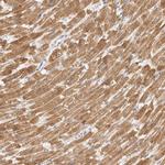 TFB2M Polyclonal Antibody